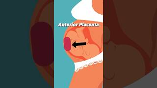 Anterior Placenta and Baby Kicks pregnancy [upl. by Dadinirt]