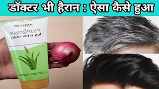 डॉक्टर भी हैरान  सफेद बालों को 1 बार मे जड़ से काला देखकर । Turn white Hair to Black [upl. by Nawek142]