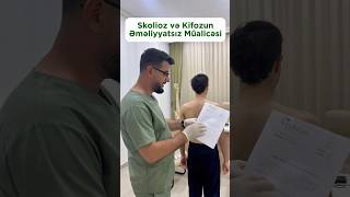 Skolioz və Kifozun Əməliyyatsız Müalicəsi fizioterapiya reabilitasiya skolioz kifoz [upl. by Magda]