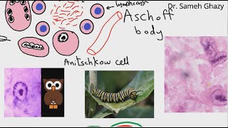 Systemic pathology 1  CVS rheumatic fever 1 الحمى الروماتيزمية DRSAMEH GHAZY [upl. by Alphonso970]