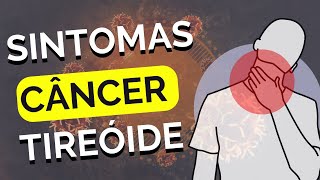 Sintomas do câncer De tireóide [upl. by Clovis]