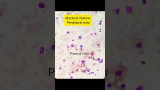 Plasma cells and Megakaryoblast identification💡👍  Cells identification  MLS Masterclass👩‍🎓👨‍🎓 [upl. by Einnalem]