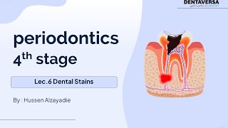 Periodontics Stage4 Lec 6 Dental Stains  DentaVersa Academy  دنتافيرسا اكادمي [upl. by Len]