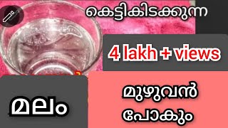 ഒരു ഗ്ലാസ്സ് കുടിച്ചാൽ 5മിനുറ്റിൽ വയർ ശുദ്ധിയാകുംമലബന്ധം ഗ്യാസ് ഇവ ഇല്ലാതാകുംconstipation solution [upl. by Piggy]