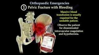 Orthopaedic Emergencies Part 1  Everything You Need To Know  Dr Nabil Ebraheim [upl. by Adierf]