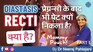 प्रेग्नन्सी के बाद भी पेट निकला हुआ What is Diastasis Recti Part 1  Dr Neeraj Pahlajani [upl. by Aleb625]