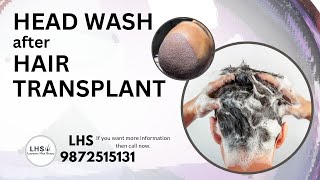 ✅ Head Wash after Hair Transplant Treatment I Ludhiana Hair Studio [upl. by Dyann817]