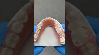 Lower TCS Unbreakable FiberFlex Partial EnvisiontecMain tcsdentalinc envisiontectcsdentalinc [upl. by Seraphim435]