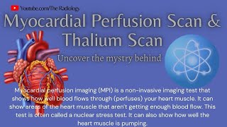 Myocardial Perfusion Scan amp Thallium Scan myocardialinfarction heartattack [upl. by Nahshun]