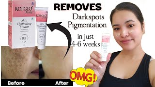 Cream for DARKSPOTS amp PIGMENTATION  Kojiglo Forte  Details in description 👇 [upl. by Adi158]