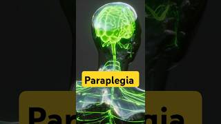 What is Paraplegia Paraplegia disability accidents [upl. by Laefar476]