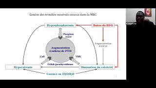 VITAMIN D AND INTACT PTH IN CONGOLESE HEMODIALYSIS PATIENTS EVALUATION OF KDIGO TARGETS French [upl. by Herring]