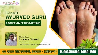 Plantar Psoriasis Symptoms and Treatment through Ayurveda  Dr Manoj Virmani  Psoriasis [upl. by Adnawyt]