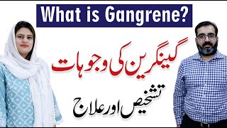 What is Gangrene Causes Diagnosis and its Treatment  Dr Usman Jamil with Dr Arooj Azam [upl. by Ahsikyw]