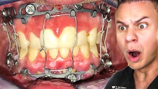 TikToks That Will Make You Want Braces [upl. by Ycal]