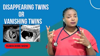 VANISHING TWINS SYNDROME What happens and what can be done [upl. by Issej]