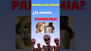 ¿El nuevo COVID Datos de la viruela del mono virueladelmono pandemia [upl. by Ellimaj144]