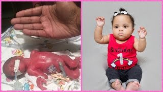 Diors Journey  Preemie Born at 23 Weeks [upl. by Zrike389]