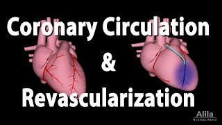 Coronary Circulation and Revascularization Animation [upl. by Ane]