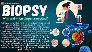 Biopsy 101 Types Importance amp What You Need to Know for Diagnosis biopsy theradiology5817 [upl. by Cirenoj460]