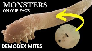 Tiny Monsters on Our Face The Shocking Truth About Demodex Mites Microscope Footage [upl. by Alvord]