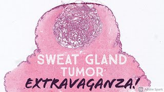 Sweat Gland Tumor Dermatopathology Board Review 31 Slides  Pathology Dermpath Dermatology [upl. by Revlys]