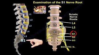 Examination Of S1 Nerve Root  Everything You Need To Know  Dr Nabil Ebraheim [upl. by Tanner536]