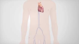 Radiofrequency Catheter Ablation [upl. by Eignat]