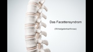 Facettensyndrom 2 Übungen gegen Rückenschmerzen [upl. by Leynad]