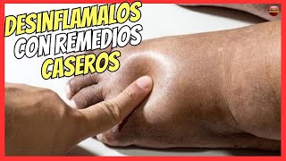 🔴 ¿COMO DESINFLAMAR LOS PIES HINCHADOS CON REMEDIOS CASEROS 🔥 [upl. by Ttenna]