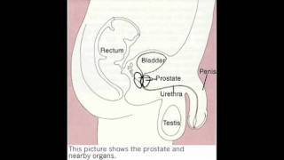 testicular self examination [upl. by Ettore]