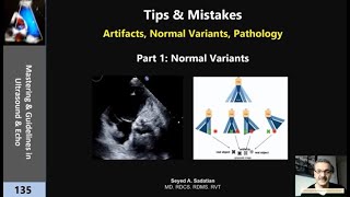 Tips amp Mistakes Artifacts Normal Variants Pathology part 1 [upl. by Nerissa]