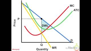 Monopoly  What You Must Know in 5 Minutes  Microeconomics [upl. by Clywd328]