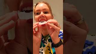 opalescence 16 carbamide peroxide professional home teeth whitening how to use guide by a dentist [upl. by Chantalle]