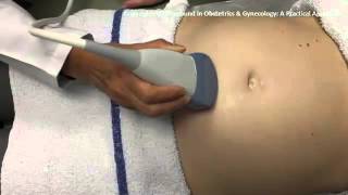 Ultrasound in Obstetrics amp Gynecology A Practical Approach  Clip 102 [upl. by Natala888]