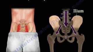 Sacroiliac Joint Dysfunction Animation  Everything You Need To Know  Dr Nabil Ebraheim MD [upl. by Anatlus]