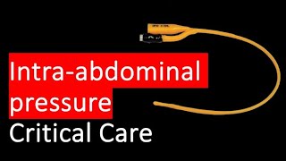 HOW and WHY do we measure intra abdominal pressure [upl. by Ahsiek]