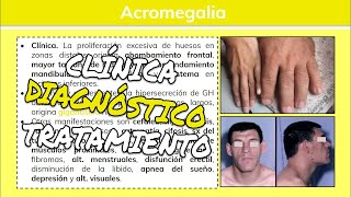 ⚕️🩺 Acromegalia y Gigantismo HIPERSECRECIÓN DE HORMONA DEL CRECIMIENTO Síntomas y Tratamiento [upl. by Aiam100]