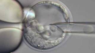 ES cell microinjection into a mouse blastocyst [upl. by Wanids451]