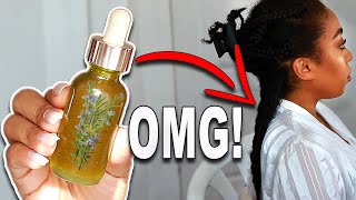 THE ULTIMATE ROSEMARY OIL FOR EXTREME HAIR GROWTH YOUR HAIR WILL NEVER STOP GROWING [upl. by Callie6]