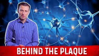 What is Plaque and How to Remove it Explained By Dr Berg [upl. by Deina]