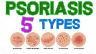 THE 5 MAIN TYPES OF PSORIASIS  PSORIASIS CLASSIFICATION [upl. by Elbys]