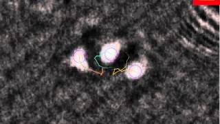 Cells dance tacking with Cytonote from IPRASENSE [upl. by Yard]