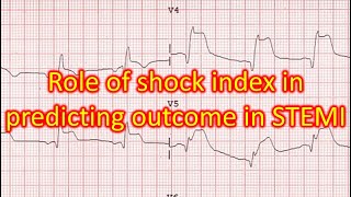 Role of shock index in predicting outcome in STEMI [upl. by Anoek]