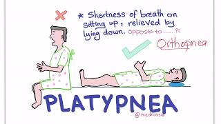 PlatypneaOrthodeoxia Syndrome [upl. by Abran234]