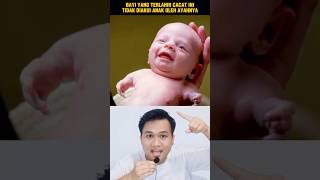 AYAHNYA TIDAK MANGAKUI BAYI CACAT INI ADALAH ANAKNYA‼️shorts alurcerita storytelling [upl. by Sulokcin]