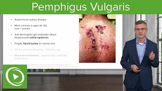 Pemphigus Vulgaris – Dermatology  Lecturio [upl. by Ahseiyt100]