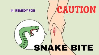 14 HOME REMEDIES FOR SNAKE BITE [upl. by Justus580]