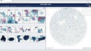 Digital Cytology Education Website Video [upl. by Higinbotham119]