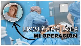 LIPOSUCCION y REMODELACIÓN 360  MI OPERACION y EXPERIENCIA Lipedema [upl. by Nicolina]